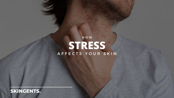 How Stress Affects Your Skin